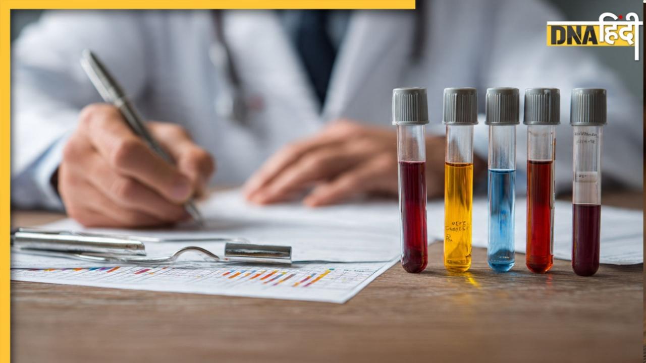 Test for Kidney: 5 सिंपल टेस्ट बता देंगे आपकी किडनी का अंदरूनी हाल, अचानक गुर्दा फेल होने का खतरा होगा कम