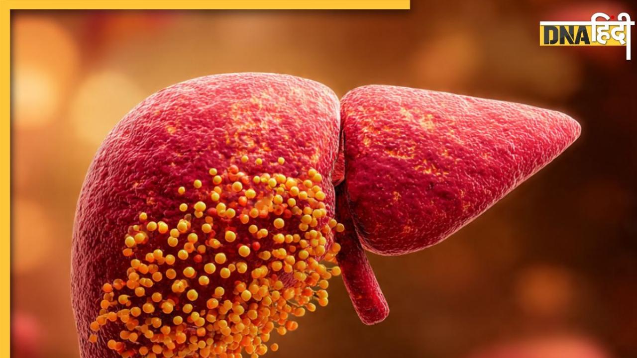 Insulin Resistance: केवल इन 3 आदतों में कर लें बदलाव, इंसुलिन रेजिस्टेंस और फैटी लिवर से मिलेगा छुटकारा! 