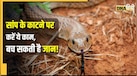 सांप काटने के बाद सबसे पहले क्या करें? जानें कौन सी बातें बचा सकती हैं जान