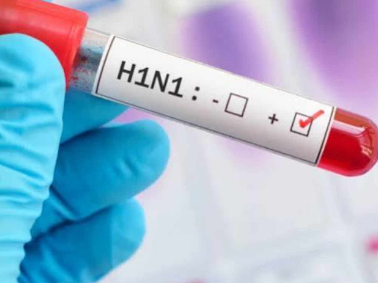 H1N1 Cases Rise in India: Why IMA warns against self-medicating with antibiotics, antivirals; doctors explain