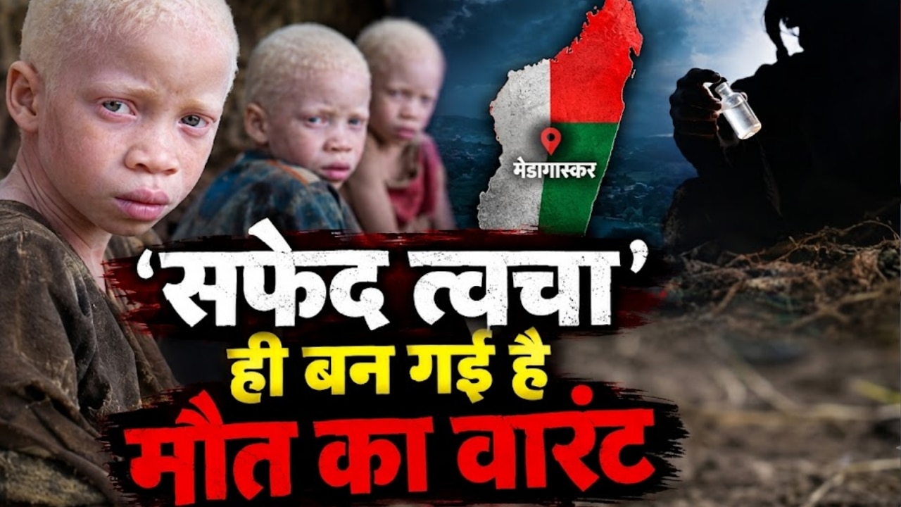 तस्करी, तंत्र-मंत्र और 13 एल्बिनो का कत्लेआम, मेडागास्कर में मासूम जिंदगियों के तन से सिर जुदा होने की खौफनाक कहानी