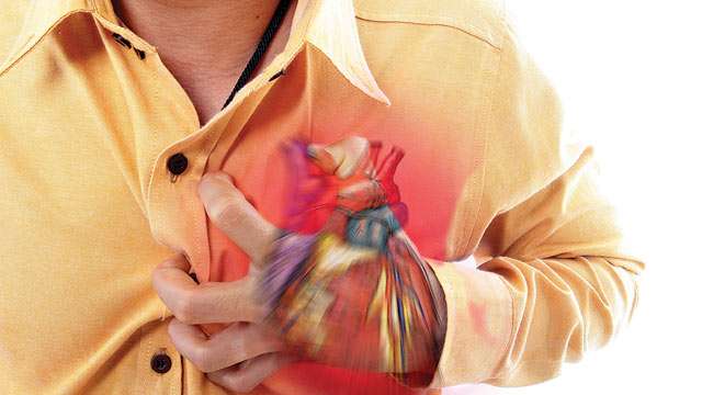 Heart attack Heart attack