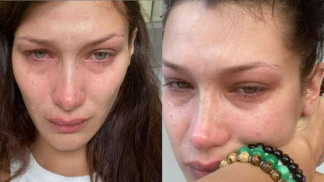 Bella Hadid Opens Up About Posting Her Depression Photos On Social Media Says This