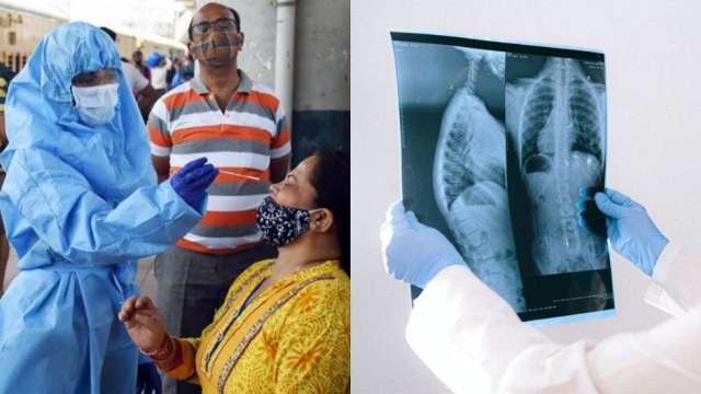 Covid-19 likely to hamper India's 'End TB' programme - Vimarsana News