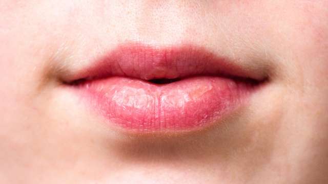 Easy ways to take care of dry, chapped lips - Vimarsana News