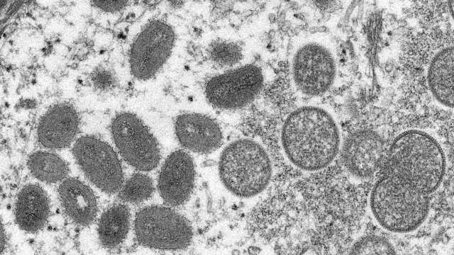Why monkeypox virus is spreading rapidly, know how many variants are there - Vimarsana News