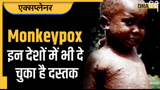 monkeypox virus update