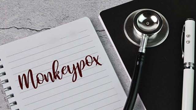 Government to issue precautionary guidelines on monkeypox - Vimarsana News
