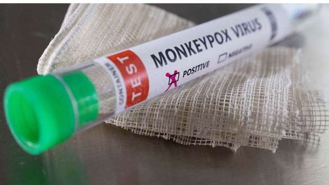 Private company develops RT-PCR based kit for Monkeypox Virus - Vimarsana News