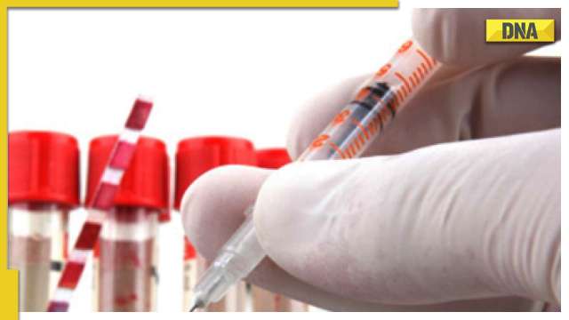 HIV drug could combat middle-aged memory loss, claims study - Vimarsana News