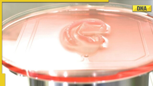 Scientists transplant world's first 3D-Printed 'living ear' onto patient with rare birth defect - Vimarsana News