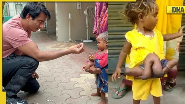 Heart-melting gesture: Sonu Sood helps Bihar girl with 8 limbs to get ...