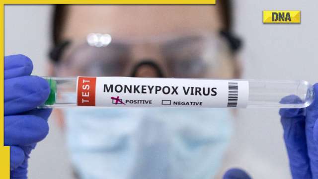 Monkeypox virus to be given a new name, here's why - Vimarsana News