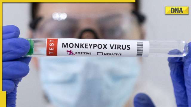 Monkeypox scare: Delhi reports third case, another Nigerian man tests positive for infection - Vimarsana News