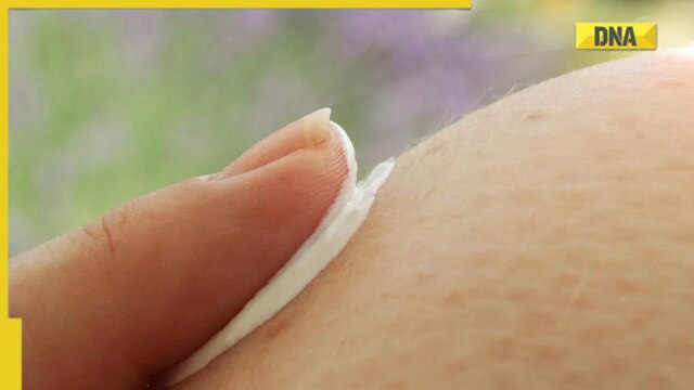 How sun exposure is linked with skin cancer - Vimarsana News