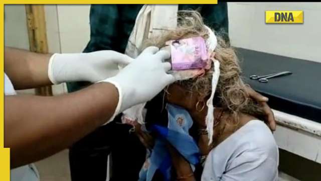 Medical negligence shocker from MP: Condom pack used to dress woman's head injury - Vimarsana News