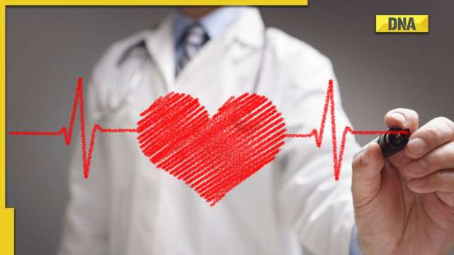 Heart attack vs cardiac arrest: Health experts explain the surge - Vimarsana News