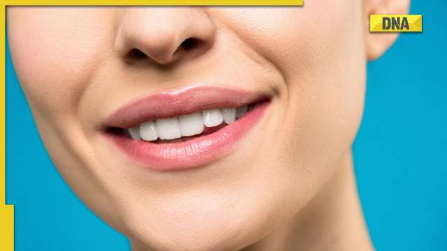 Oral health: What causes tooth discoloration? - Vimarsana News