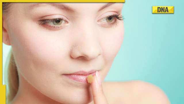 Do's and dont's to get a chapped-free lips - Vimarsana News