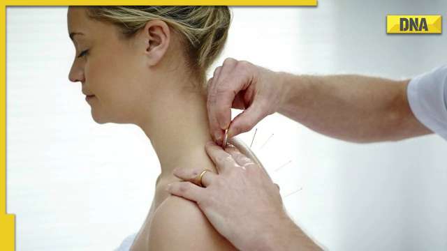Can chronic asthma be cured by Acupuncture? All you need to know - Vimarsana News