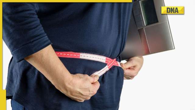Procedures for weight loss surgery made easier with new guidelines, know here - Vimarsana News