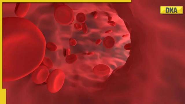 Suffering from iron deficiency? Check these 5 foods to increase your hemoglobin level - Vimarsana News