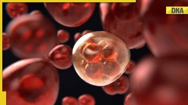 Britain doctors treat blood cancer through DNA alteration, know about the new 'base editing' therapy - Vimarsana News