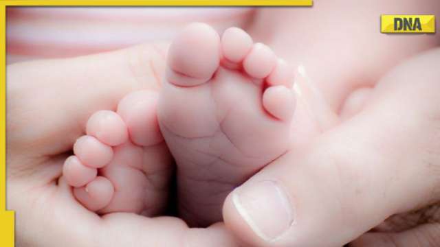 Extraordinary birth in Madhya Pradesh: Baby girl with 'four legs' born in Gwalior - Vimarsana News