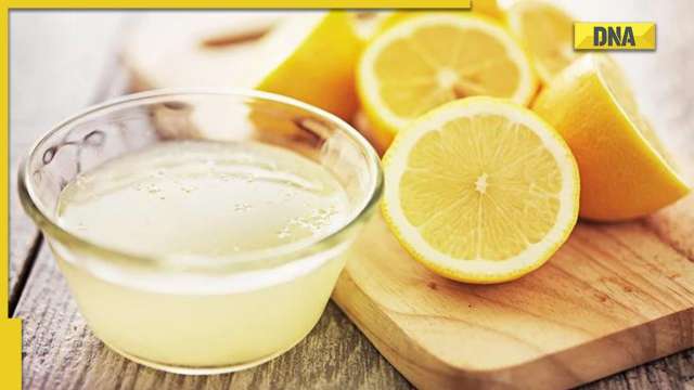 Hair care for winters: Is lemon really helpful in reducing dandruff problem? - Vimarsana News