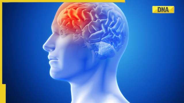 5 reasons that increases the risk of brain stroke in winter - Vimarsana News