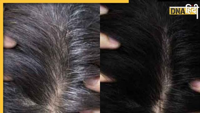 White Hair Remedy: इन नेचुरल चीजों से सफेद बाल होंगे Black, 50 साल की उम्र  में