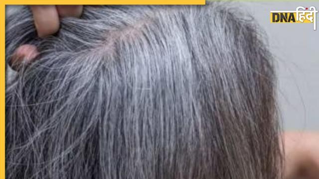 White Hair Tips: रात में सोते समय बालों में लगाएं तेल में मिलाकर ये चीज, White White Hair Tips: रात में सोते समय बालों में लगाएं तेल में मिलाकर ये चीज, White