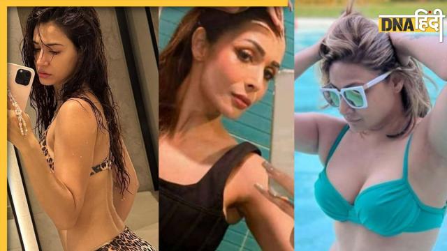 Bollywood Actress Flaunts Stretch Marks: बॉलीवुड एक्ट्रेस ने दिखाए स्ट्रेच मार्क्स