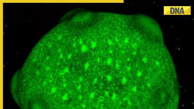 What are 'minibrains' and why scientists are growing them in labs? - Vimarsana News