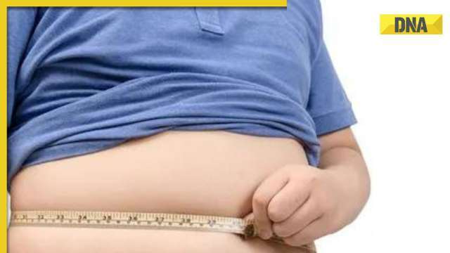 Childhood obesity cases likely to spike in India by 2035: Here's how to control it - Vimarsana News