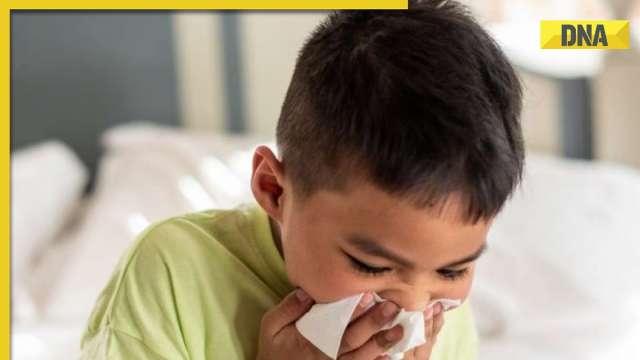 RSV infections rising among children: What is respiratory syncytial virus? Know symptoms, treatment - Vimarsana News