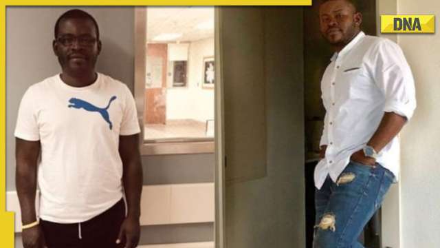 Man undergoes painful surgeries, spends Rs 1.35 crore to increase his height by 5 inches; then vs now pic - Vimarsana News