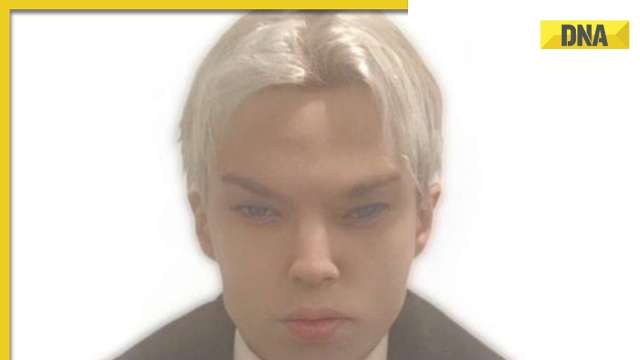 22-year-old Canadian actor Von Colucci dies after undergoing 12 surgeries to look like BTS' Jimin - Vimarsana News