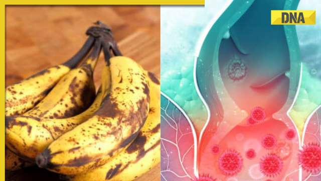 Banana for piles: Know how and when to consume banana as per Ayurveda - Vimarsana News
