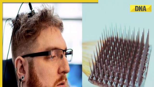 Brain chips implanted in people to cure fatal ailments; know new technique of biotech firm - Vimarsana News