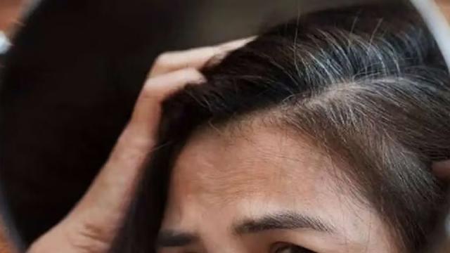 ASGAR Healthcare Group  How To Prevent Premature White Hair Read   httpsasgargroupcomhowtopreventprematurewhitehair When you notice white  hairs in your early 30s and sometimes even 20s its absolutely  disheartening Both gray and