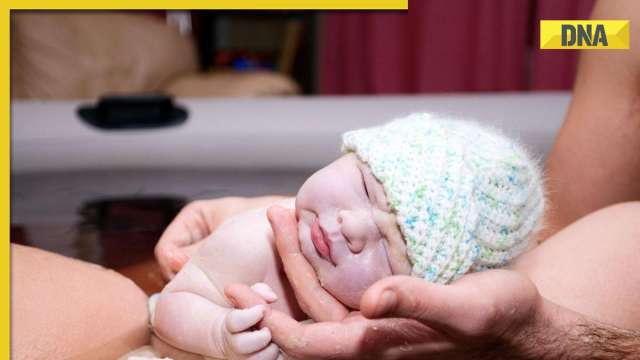 Water birth: Everything to know about this natural, painless delivery option - Vimarsana News