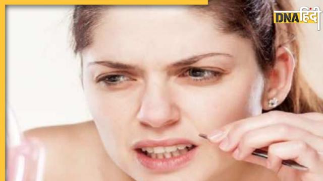 Get Rid of Unwanted Hair Permanently With These Simple Home Remedies