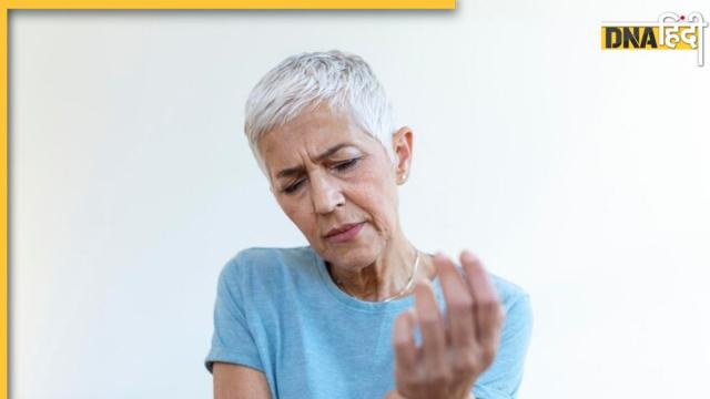 Arthritis Home Remedies