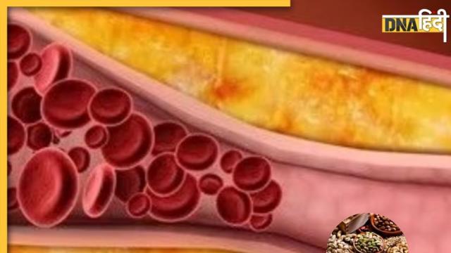 Cholesterol