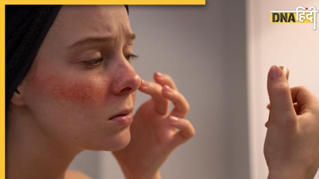 Summer Skin Care
