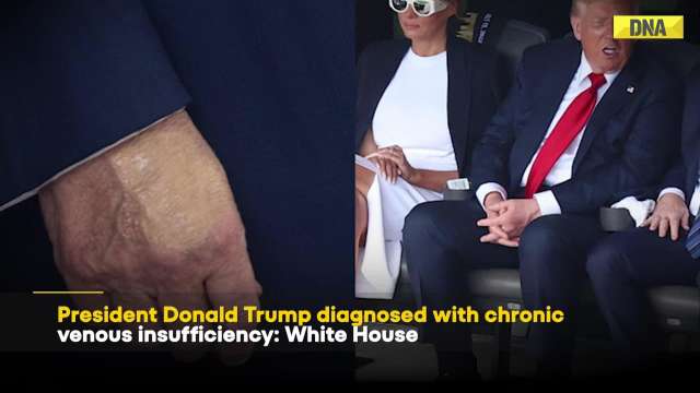  US News: President Donald Trump Diagnosed With Chronic Venous Insufficiency Confirm White House