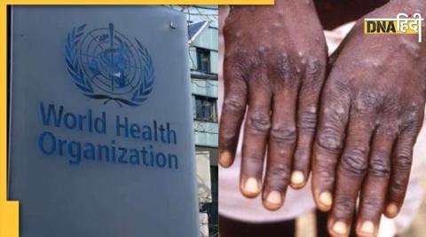 WHO statement came amid increasing infection of Monkeypox, advised people to be cautious