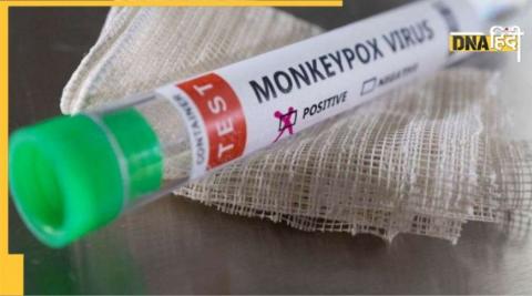 monkeypox test kit