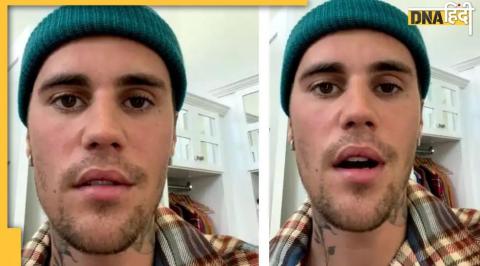 Justin Bieber, Ramsay Hunt Syndrome, Justin Bieber disease, Justin Bieber syndrome, facial paralysis, facial paralysis reason in hindi, facial paralysis treatment in hindi, facial paralysis reason